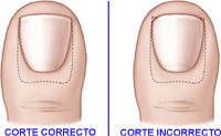 corte_uñas podología galapagar